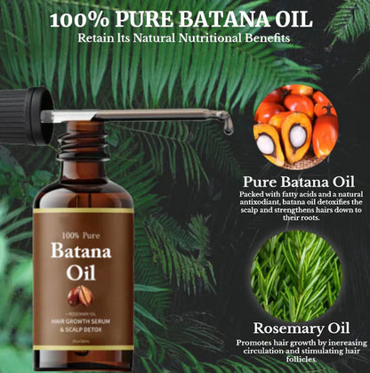 🖤2026 New Year · 30% OFF🖤Pure Batana Oil for Hair Growth