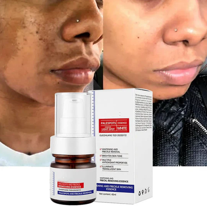 Vitamin C Whitening Freckles ESSENCE